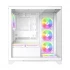 1st Player Mi8 Casing Price in BD